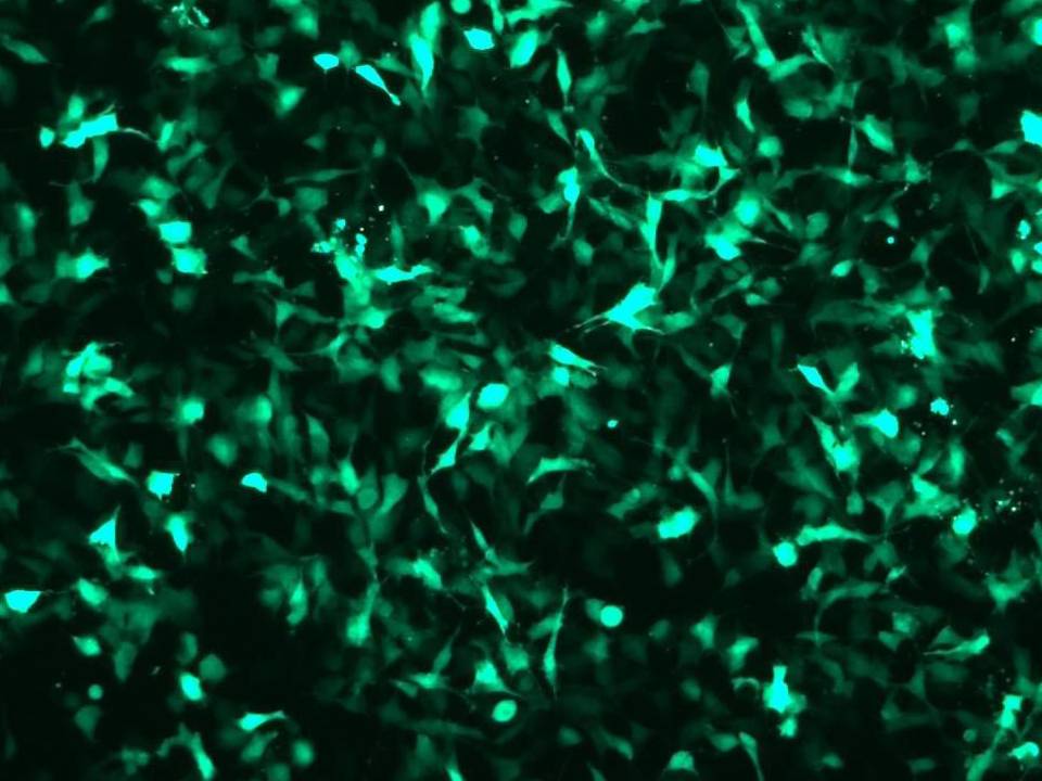 NEPA21 / HTR-8 Svneo - Human Trophoblast cells - Transfection Efficiency 67 per cent